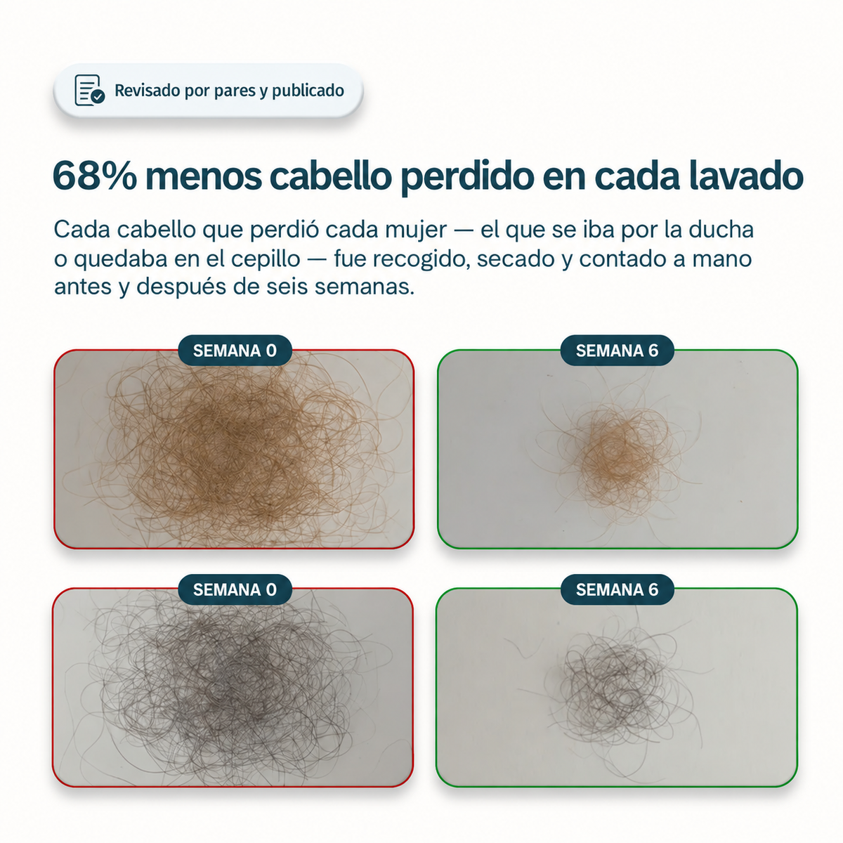 Ebond™ — Serum Capilar Anticaída y Densidad