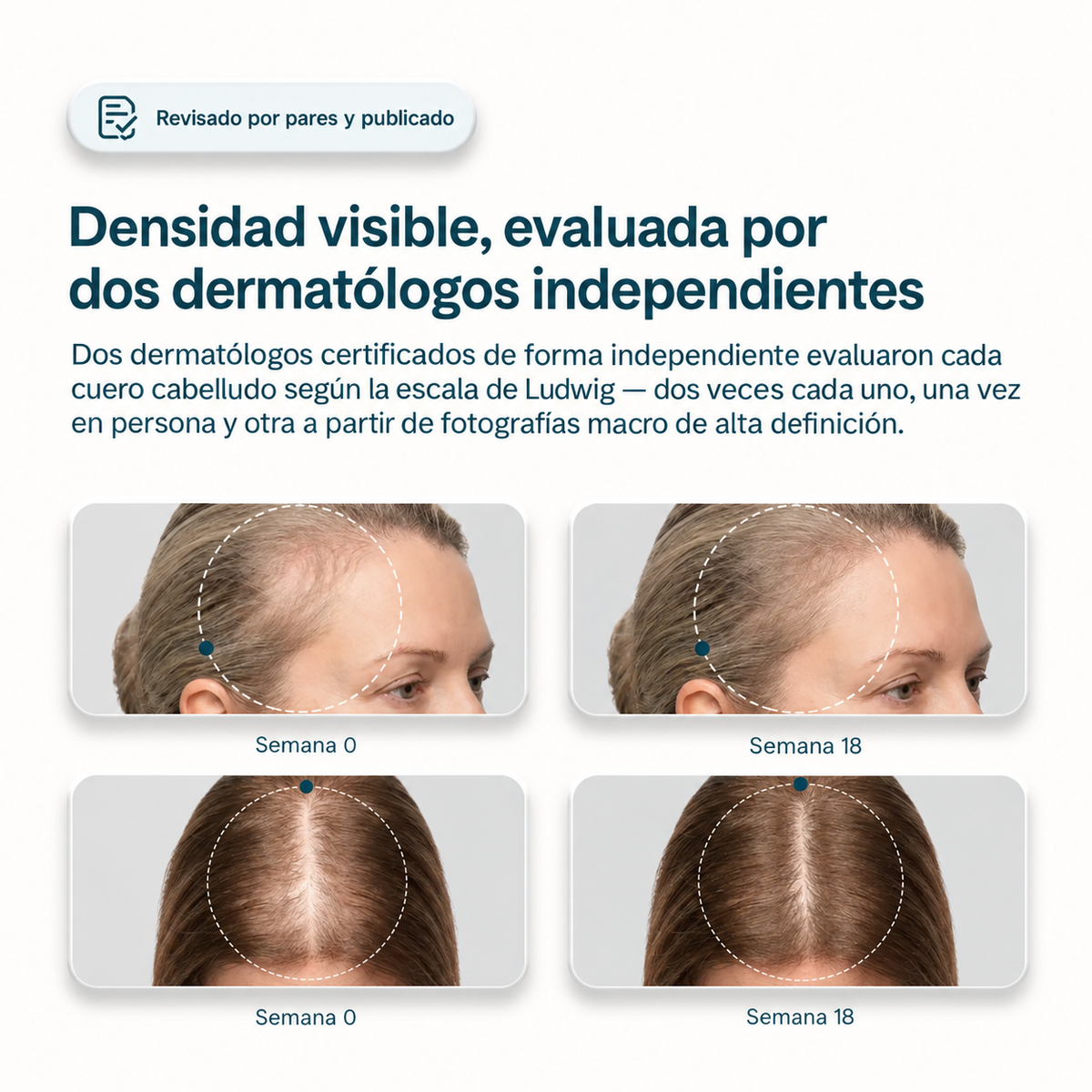 Ebond™ — Serum Capilar Anticaída y Densidad